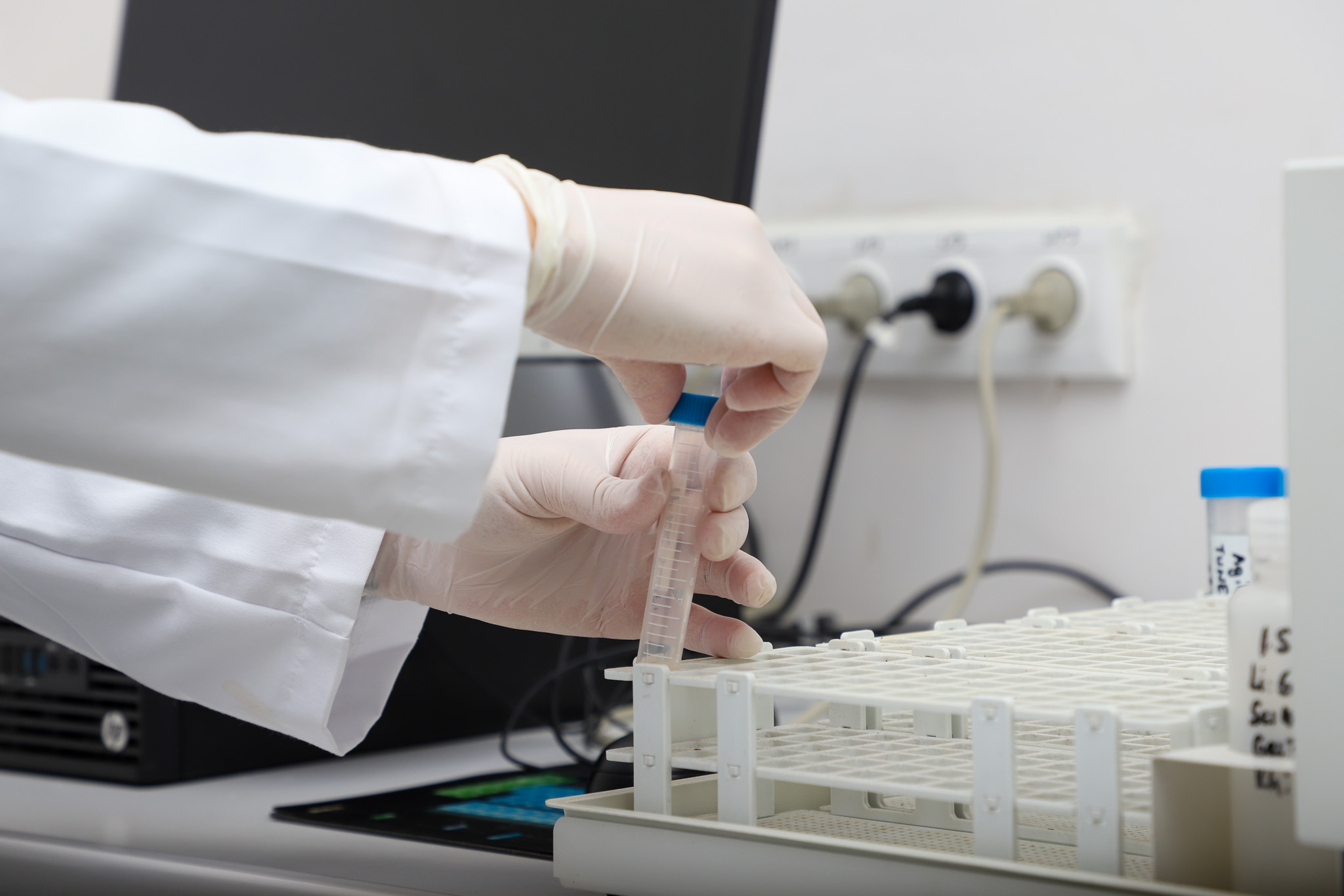 “Dev altyapı hamlesi ile su kayıplarının önüne geçiyoruz”